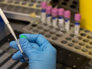 Dit betekent de wereldwijde WHO-waarschuwing voor apenpokken