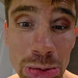 Video | Gehavende Rico Verhoeven stapt op weegschaal richting titelgevecht