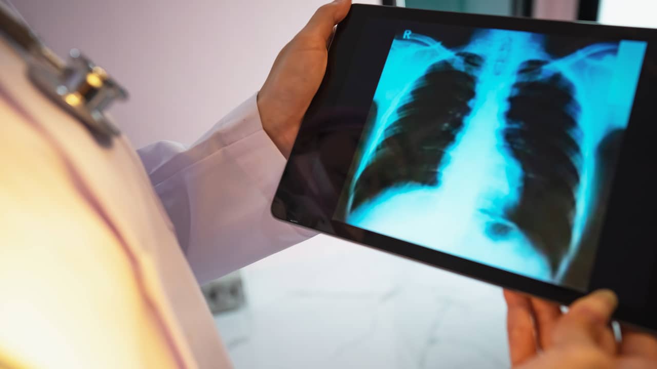 App van Maastricht UMC+ 'hoort' aan stem of iemand longaanval krijgt