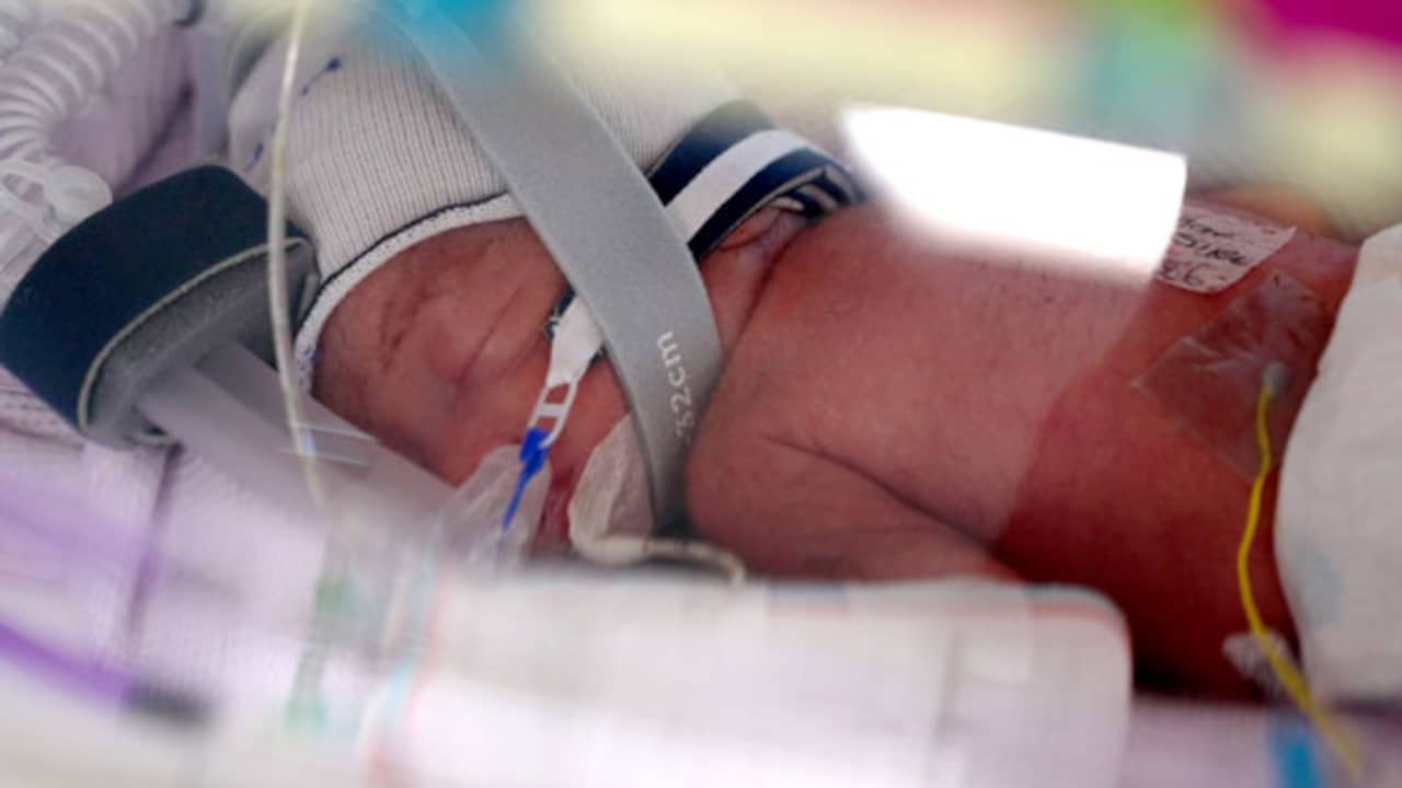 Vrouw die al vier kinderen heeft krijgt zeer zeldzame eeneiige vierling in Australië