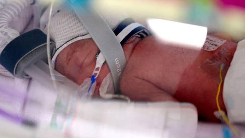 Vrouw die al vier kinderen heeft krijgt zeer zeldzame eeneiige vierling in Australië