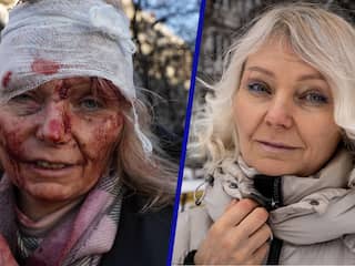 Zo gaat het na twee jaar strijd met het 'gezicht van de Oekraïne-oorlog'