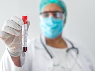 Wanneer is iemand besmettelijk? Antwoord op jullie vragen over de apenpokken