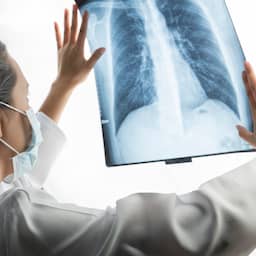 Amsterdam UMC eerste ziekenhuis in EU dat longtumor met verhitting behandelt
