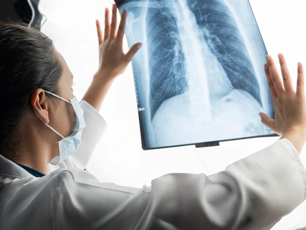 Nederlands ziekenhuis eerste in EU dat longtumor van binnen met hitte behandelt