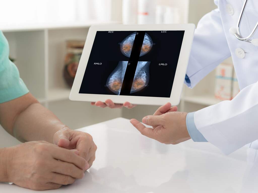 Britse wetenschappers ontwikkelen slimme beha voor vrouwen met borstkanker