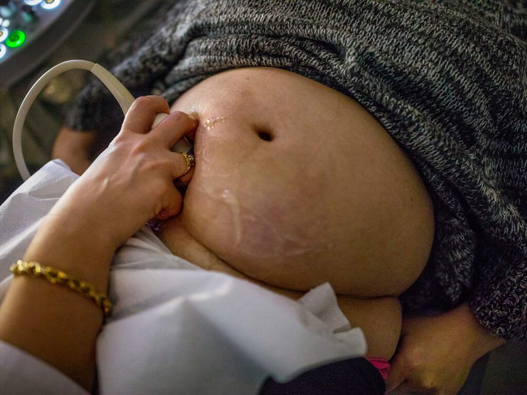 Moeder- en babysterfte in de wereld neemt maar niet af volgens WHO