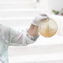 Vrouwen krijgen geen compensatie voor implantaten met hoger risico op kanker