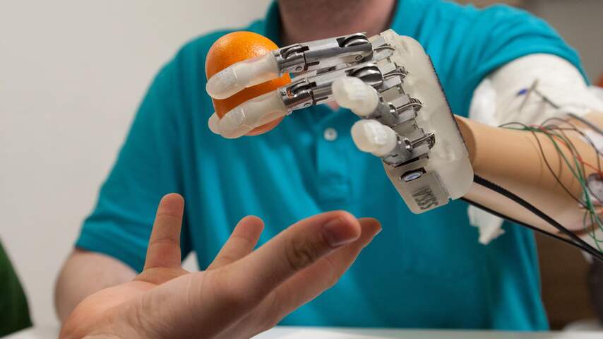 Bionische hand laat patiënt 'voelen' | Tech | NU.nl