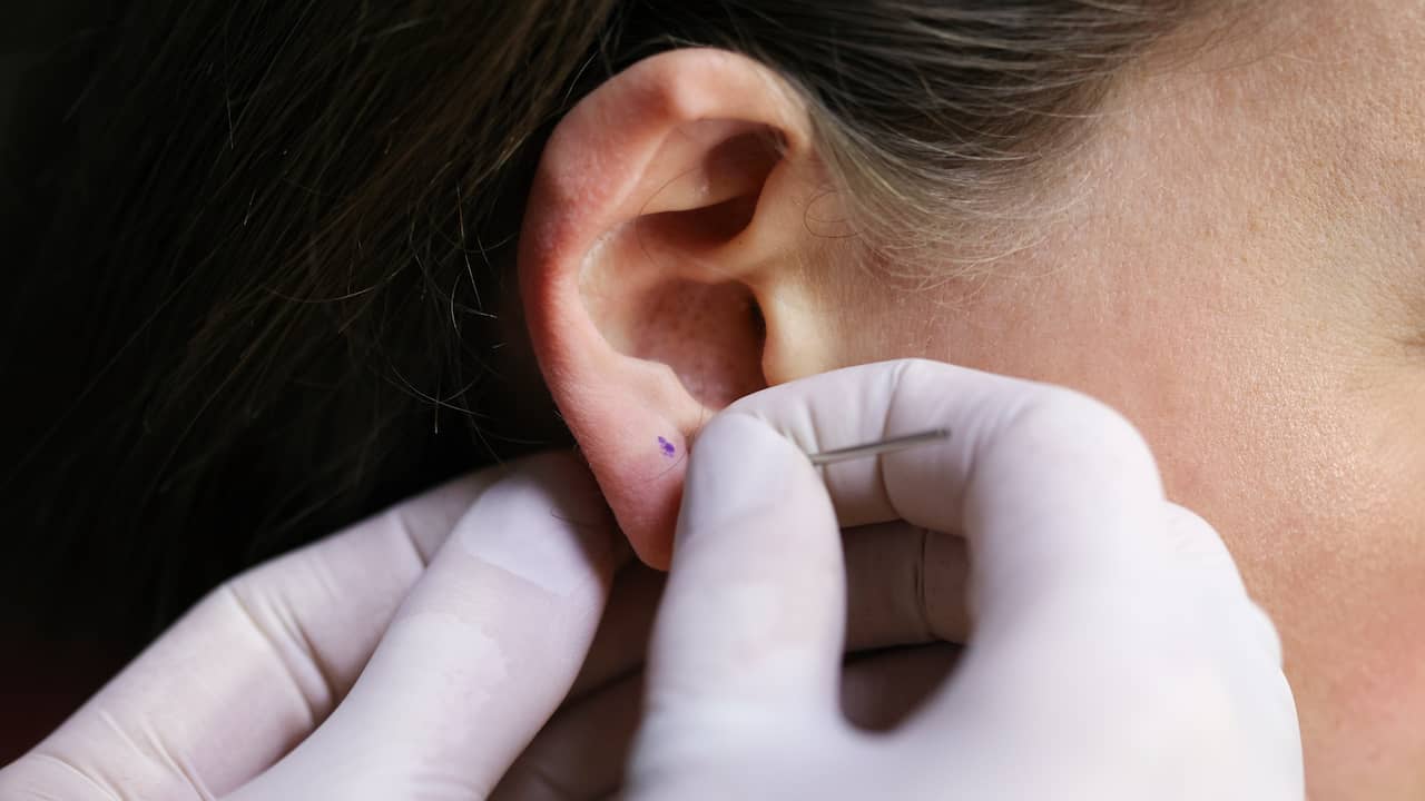 Piercingstudio in Coevorden sluit na oorinfecties bij 150 klanten