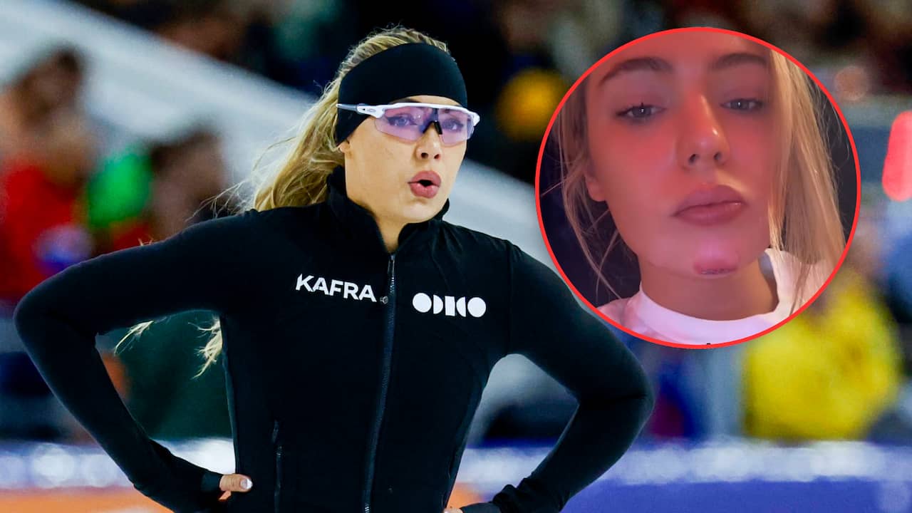 Jutta Leerdam raakt gewond bij aanrijding met 'onoplettende' automobilist