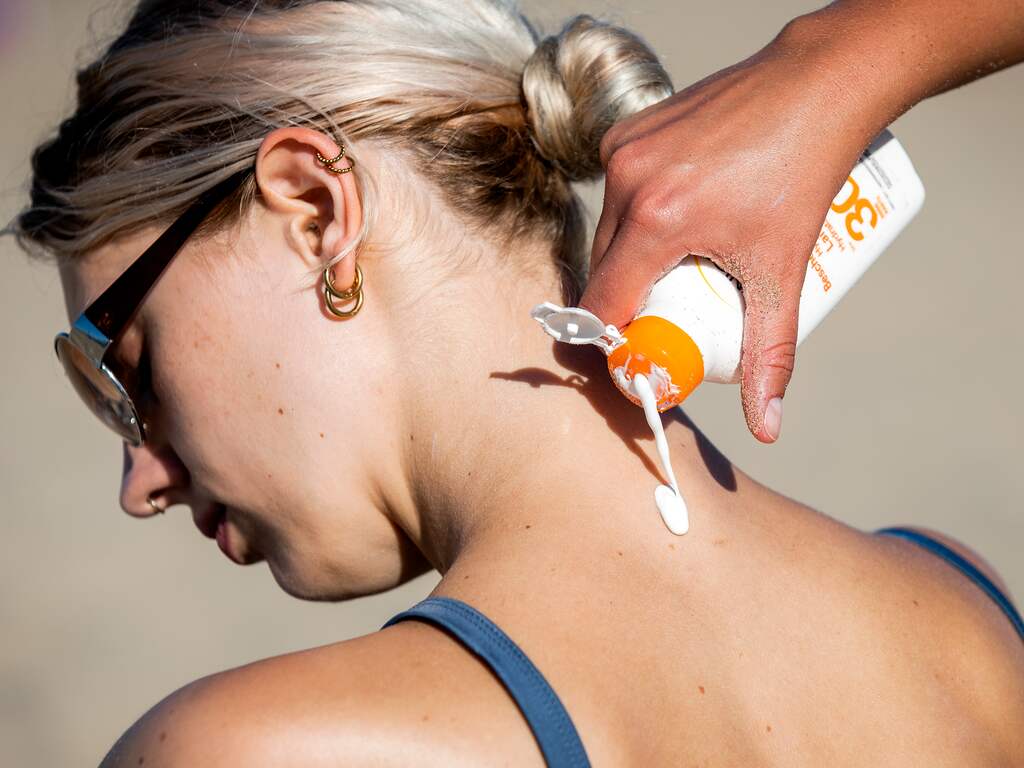 Dermatologen pleiten voor gratis zonnebrandcrème en meer schaduwplekken