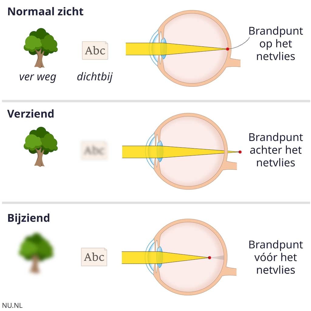 Scherp De gevolgen van te veel schermtijd terugdraaien: kan dat? | Slimmer ...