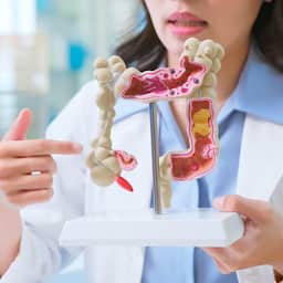 Immunotherapie lijkt veelbelovend bij specifieke vorm van darmkanker