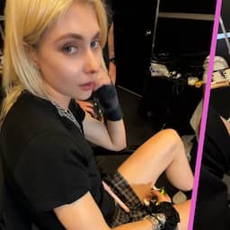 Video | Zangeres loopt voor tweede keer tijdens tour met AC/DC dierenbeet op