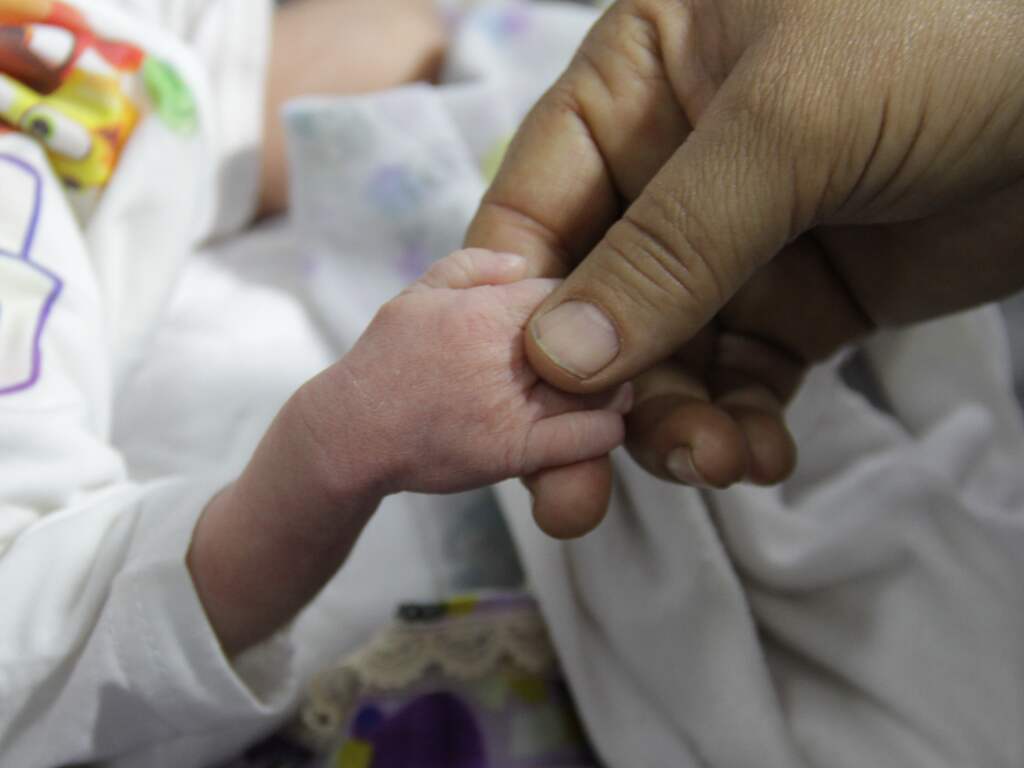 Een op de drie kleine kinderen in noorden Gaza lijdt aan acute ondervoeding